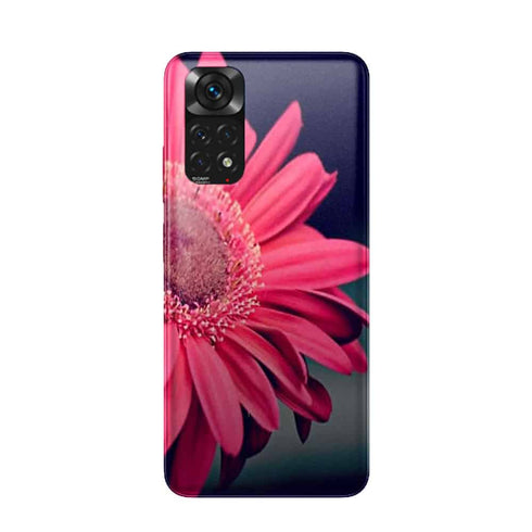 Coque Xiaomi Redmi Note 11 Pure Beauty