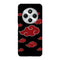 Coque Xiaomi Redmi 14C Akatsuki Nuages