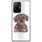 Coque Xiaomi 11T 5G Regard Teckel | Housse Silicone, Etui Antichoc | Motif Race de Chien