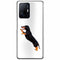 Coque Xiaomi 11T 5G Teckel Story | Housse Silicone, Etui Antichoc | Motif Race de Chien