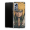 Coque Xiaomi 12 5G Naruto Hokage Minato Namikaze Signe Main Regard Ninja Naruto